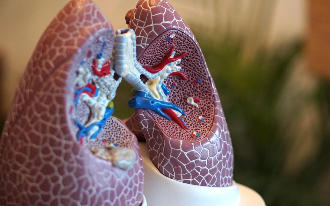Specializant infektolog David Zupančič: »Vsi imamo siva pljuča«